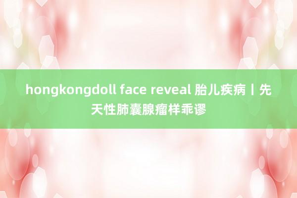 hongkongdoll face reveal 胎儿疾病丨先天性肺囊腺瘤样乖谬